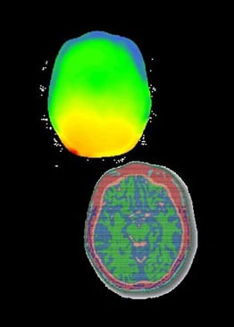 Electromagnetic Simulation Used to Evaluate Safety of Combining EEG and MRI
