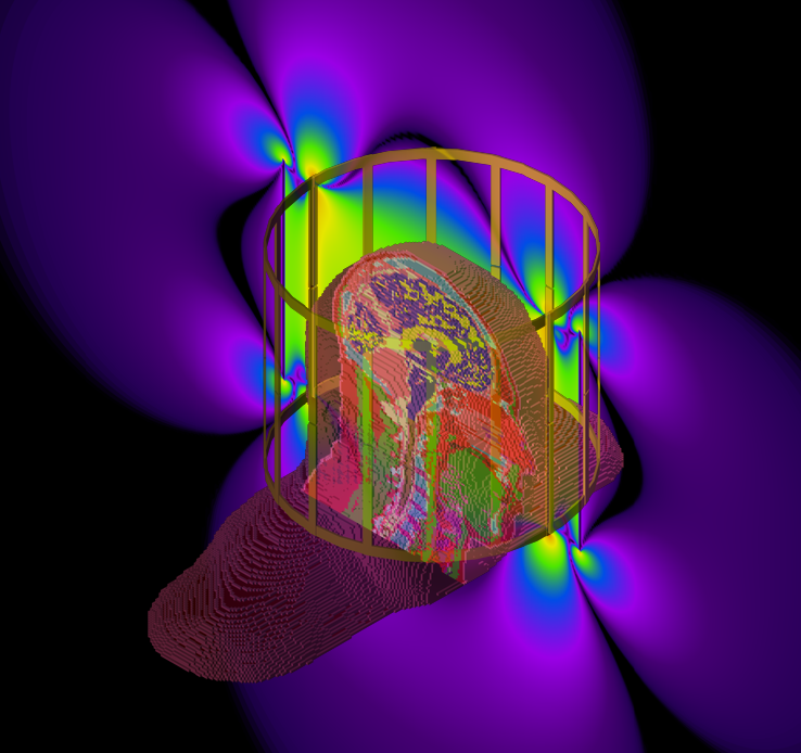 Biomedical Applications of Electromagnetic Field Simulations