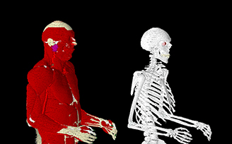 VariPose-Biological-Mesh-Repositioning