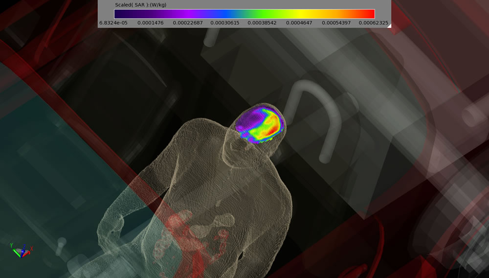 Figure 5: The 1g averaged SAR plotted in a slice of the driver's head.