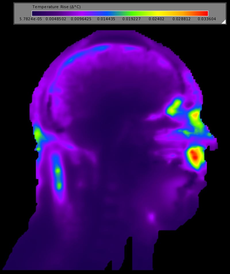 Figure 10: The temperature rise from the birdcage coil in the sagittal plane of the head.