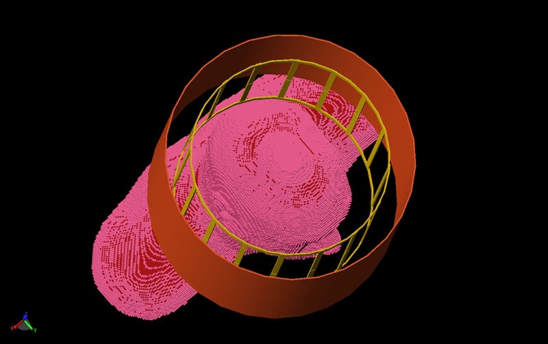 Figure 5: Coil loaded with human head.