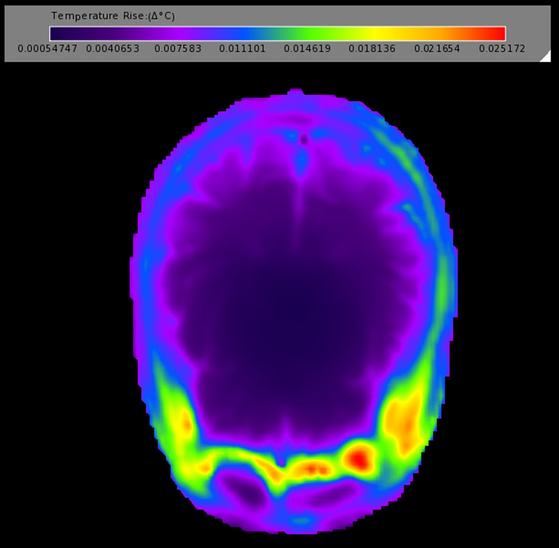 Figure 11: The temperature rise from the birdcage coil in the axial plane of the head.