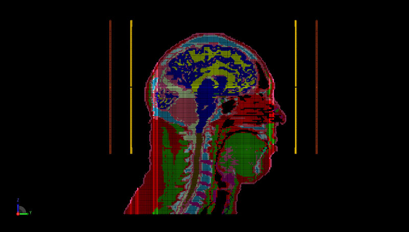 Figure 7: PrOGrid mesh representation of the sagittal plane of the head and coil geometry.