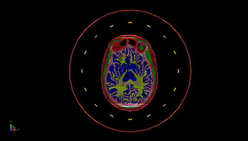 Figure 6: PrOGrid mesh representation of the axial plane of the head and coil geometry.