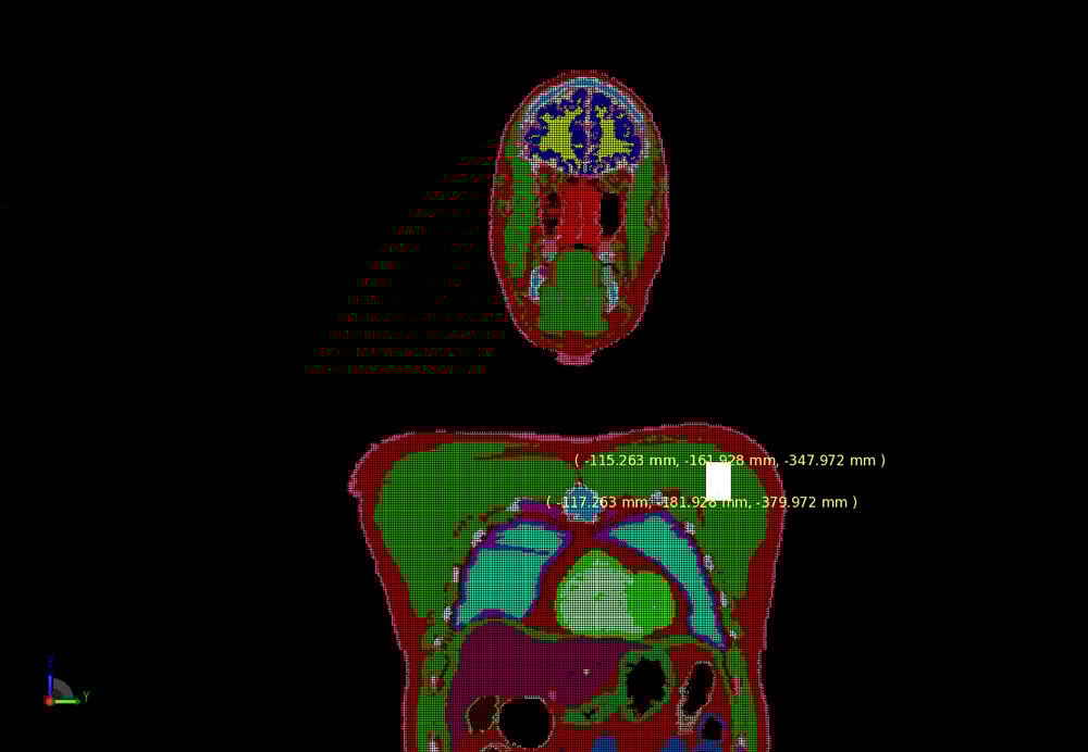 Figure 5: Mesh of the patch antenna in the body.