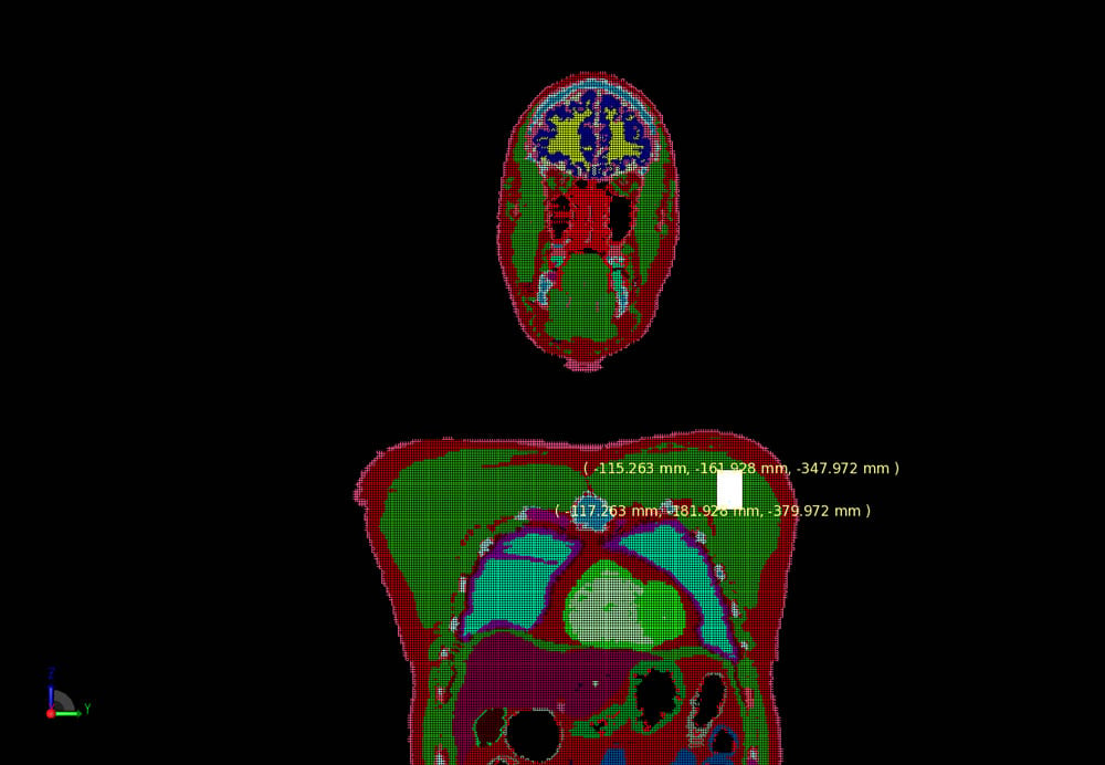 Figure 5: Mesh of the patch antenna in the body.