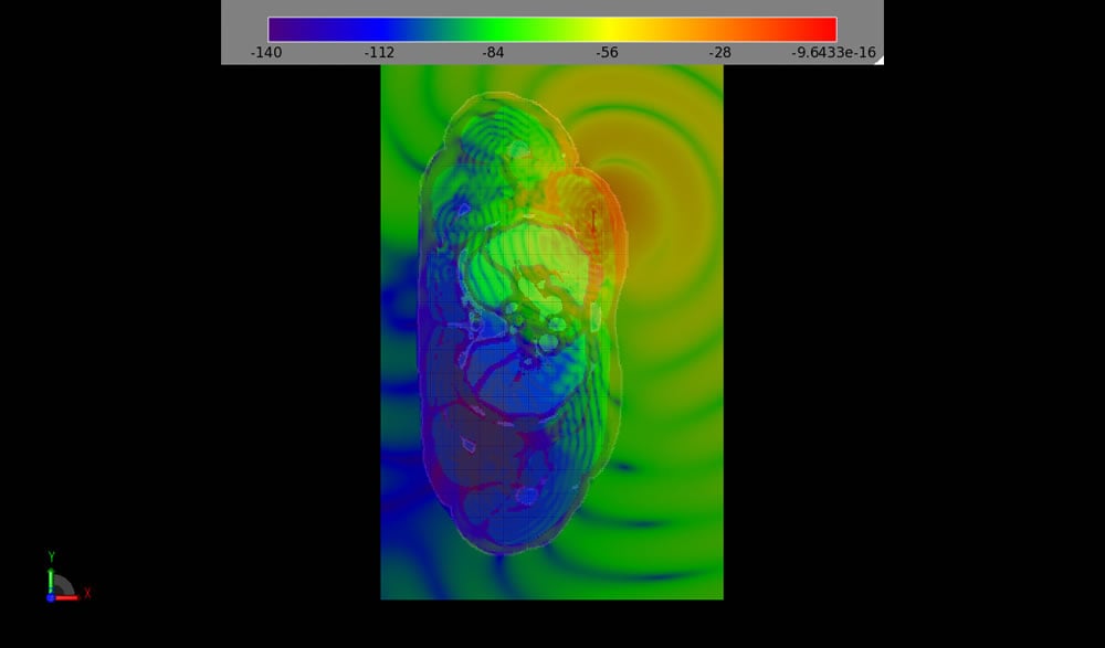  Figure 9: A slice of time domain fields through the chest (body rendering is on).