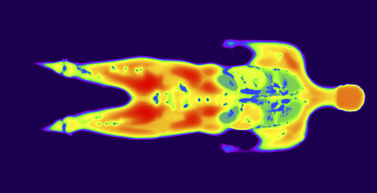 Temperature-increase